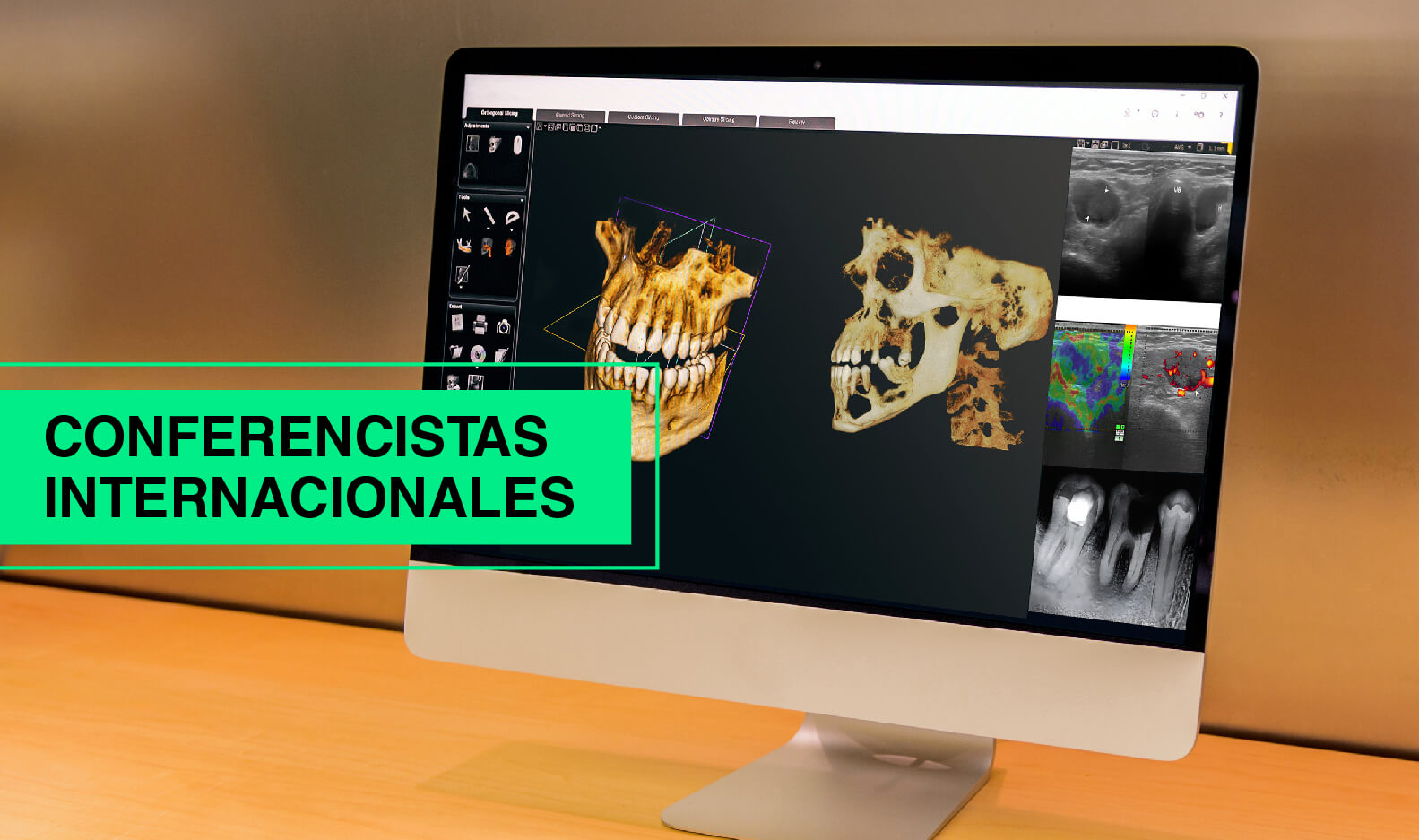 I Congreso Internacional Herediano de Radiología Bucal y Maxilofacial Lima – Perú