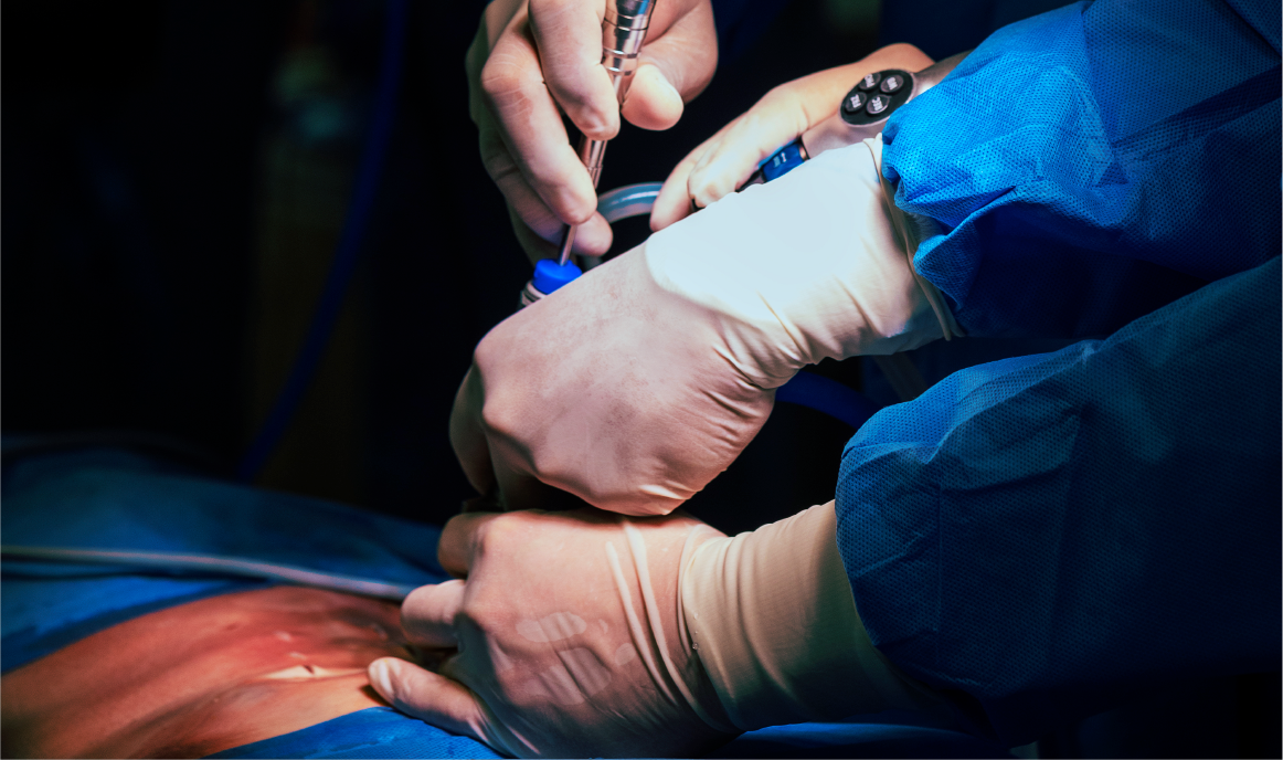 Curso Anual Herediano de Cirugía Endoscópica de Columna