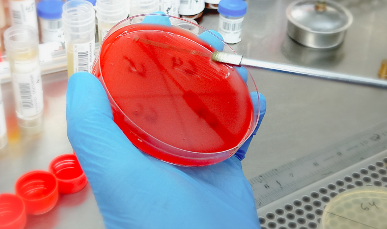 Técnicas Básicas en Microbiología